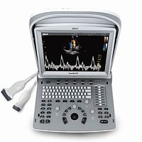 Portable ultrasound system SonoRad K9for multipurpose ultrasound imagingB/Wcolor doppler