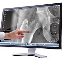 Radiology software image analysisinfection controldesign