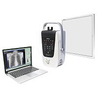 Portable radiography system Beatle-02P digitalfor chest radiographywithout table