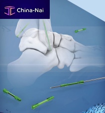 Foot arthrodesis screw anklehandcannulated