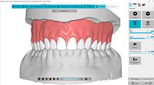Dental software BDCreator® PLUSanalysisdesignimport