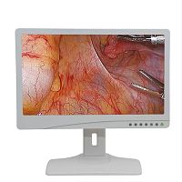 Endoscopy display