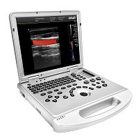 Musculoskeletal ultrasound imaging system DW-L3portablefor multipurpose ultrasound imagingfor abdominal and pelvic ultrasound imaging