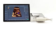 Portable ultrasound system SmartUs for multipurpose ultrasound imagingB/Wcolor doppler