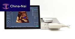 Portable ultrasound system SmartUs for multipurpose ultrasound imagingB/Wcolor doppler