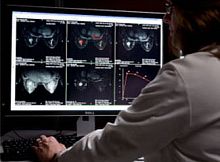 Radiography software AuroraCADfor mammographyvisualizationdiagnostic