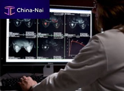 Radiography software AuroraCADfor mammographyvisualizationdiagnostic
