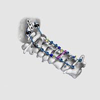 Occipito-cervical osteosynthesis unit posterioradult