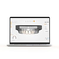 Dental laboratory software UPCADmanagementdesignCAD