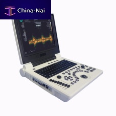 Portable ultrasound system E20for multipurpose ultrasound imagingcolor dopplerconvex-array