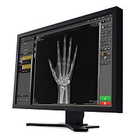 Medical imaging software Image Suite V4managementfor archivingvisualization