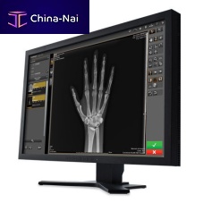 Medical imaging software Image Suite V4managementfor archivingvisualization