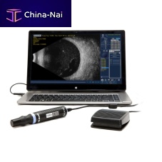 On-platform, tabletop ultrasound system B-Scan Plusfor ophthalmic ultrasound imagingB/W