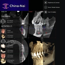 Dental iOS application mRomexisfor dental imagingclinicalvisualization