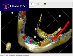Surgical software Winmedfor dental imagingdental3D viewing