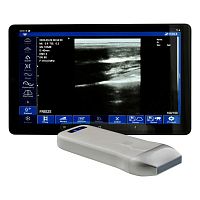 Hand-held ultrasound system WU9 seriesfor multipurpose ultrasound imagingB/Wall-in-one probe