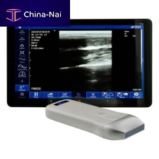 Hand-held ultrasound system WU9 seriesfor multipurpose ultrasound imagingB/Wall-in-one probe