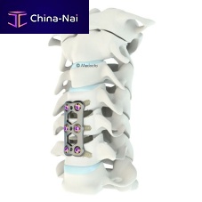 Cervical arthrodesis plate Mecta®-C lockingmetallic