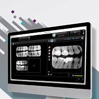 Dental software for dental imagingdiagnostictreatment