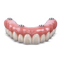 Zirconia dental prosthesis BruxZir®anterior teethposterior teeth