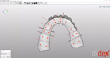 Dental laboratory software didex manufacturingmodeling3D printing
