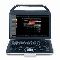 Portable ultrasound system C50for multipurpose ultrasound imagingB/Wcolor doppler