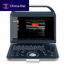 Portable ultrasound system C50for multipurpose ultrasound imagingB/Wcolor doppler
