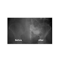 Medical imaging software 1000-925-011image enhancement