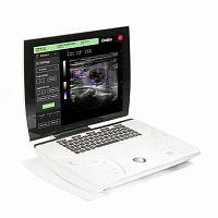 Portable ultrasound system Ondinafor gynecological and obstetric ultrasound imagingfor multipurpose ultrasound imagingfor cardiovascular ultrasound imaging