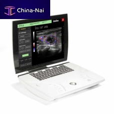 Portable ultrasound system Ondinafor gynecological and obstetric ultrasound imagingfor multipurpose ultrasound imagingfor cardiovascular ultrasound imaging
