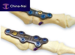 Foot phalange arthrodesis plate CheckMATE®non-lockingmetallic