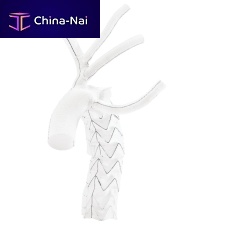 Descending thoracic aorta stent graft E-vita® Open Neoaortic archnitinolePTFE
