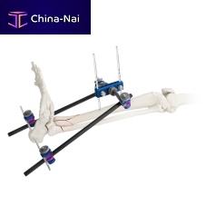 Ankle external fixation system ARBOR®tubularadult
