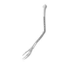 Elbow arthrodesis plate SM16005lockingtitanium