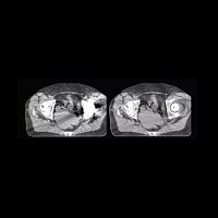 Orthopedic software O-MARmedical imaginganatomyvisualization