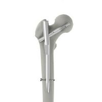 Femoral intramedullary nail INTERNA® PFNproximal fixationmetallic
