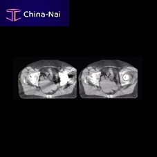 Orthopedic software O-MARmedical imaginganatomyvisualization