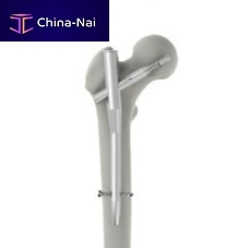 Femoral intramedullary nail INTERNA® PFNproximal fixationmetallic
