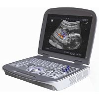 Portable ultrasound system 6600PLUSfor multipurpose ultrasound imagingB/Wcolor doppler
