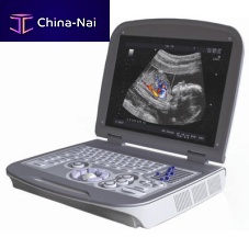 Portable ultrasound system 6600PLUSfor multipurpose ultrasound imagingB/Wcolor doppler
