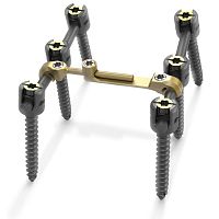 Thoraco-lumbar osteosynthesis unit Quantum®posterioradult