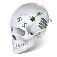 Non-absorbable cranial fixation system AGOFIX