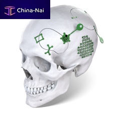 Non-absorbable cranial fixation system AGOFIX