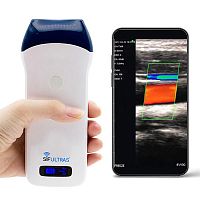 Hand-held ultrasound system SIFULTRAS-5.34for musculoskeletal ultrasound imagingB/Wcolor doppler