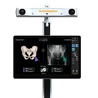 Hip prosthesis positioning surgical navigation system RIoptical