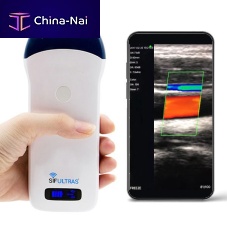 Hand-held ultrasound system SIFULTRAS-5.34for musculoskeletal ultrasound imagingB/Wcolor doppler