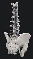 Thoraco-lumbar osteosynthesis unit SYNSTER® DOMINOposterioradult