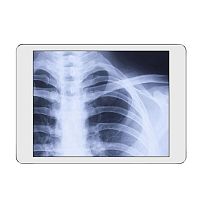 Radiography acquisition system iRay DRportable
