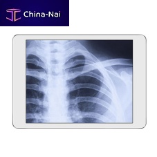 Radiography acquisition system iRay DRportable