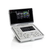 Portable ultrasound system MyLabOmegafor multipurpose ultrasound imaging3D/4Dcolor doppler